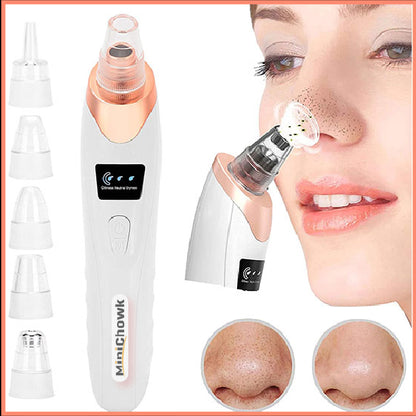 Rechargeable Derma Suction Electric Facial Pore Vacuum Blackhead Remover - 4-in-1 Skin Care Device